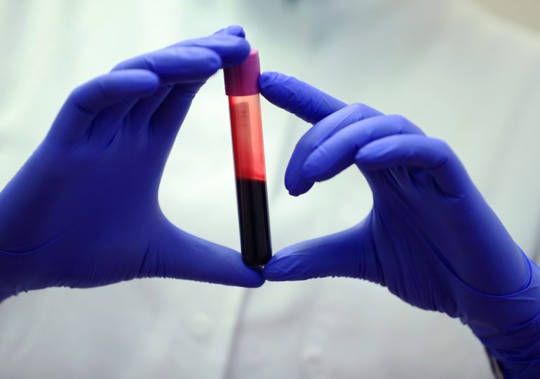 A Blood Test for Alzheimer’s Disease Is Almost Here
