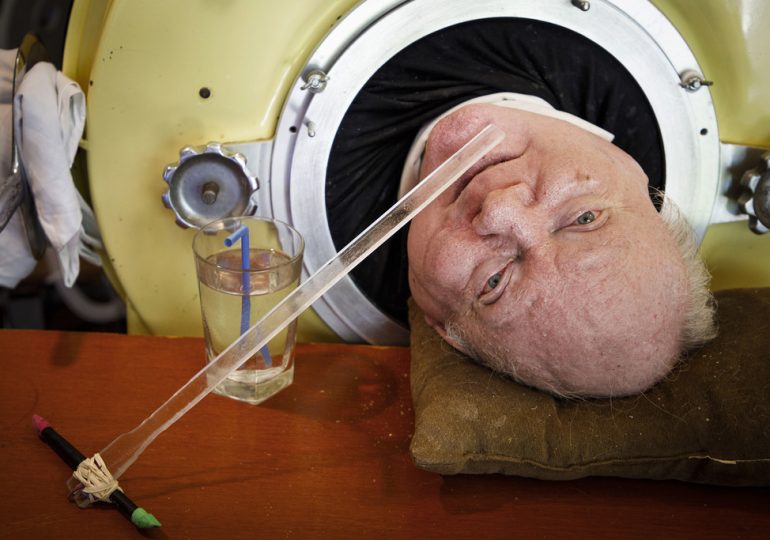 Paul Alexander, Polio Patient With Iron Lung and Positive Outlook, Dies at 78