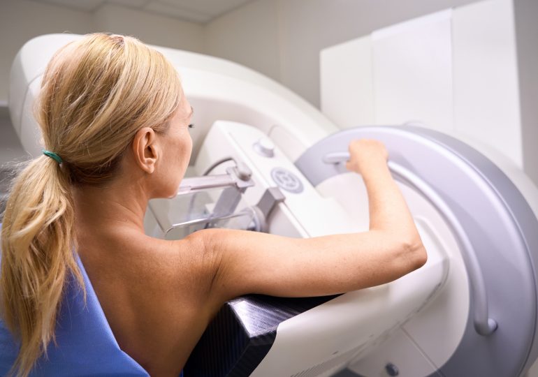When Should You Get a Mammogram? 10 Years Sooner Than You Think