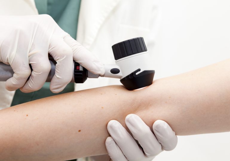 What to Expect at a Skin Cancer Screening 