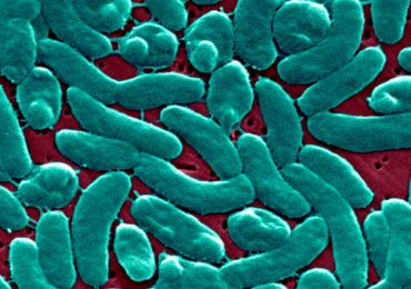 ‘Flesh-Eating’ Bacteria Cases Are on the Rise Along the Gulf Coast. How Do You Get It, and How Can You Protect Yourself?