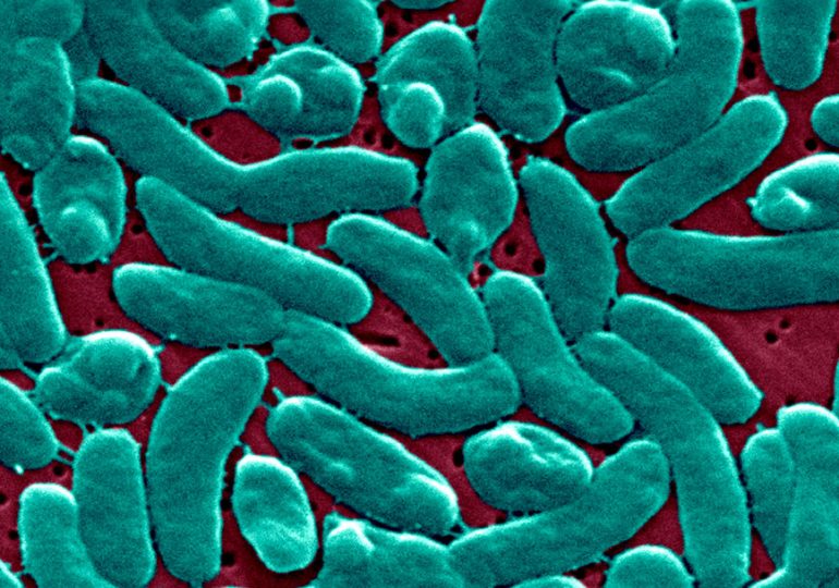 ‘Flesh-Eating’ Bacteria Cases Are on the Rise Along the Gulf Coast. How Do You Get It, and How Can You Protect Yourself?