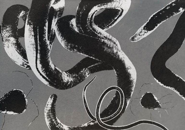 You Might Be Hosting a Parasite Right Now. Here’s How to Tell