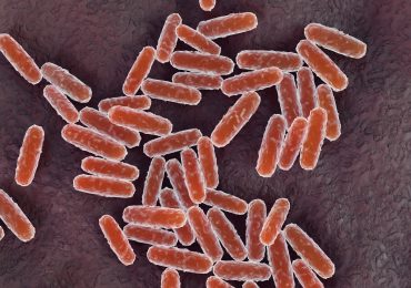 A California Resident Tests Positive for Plague. What to Know About the Disease