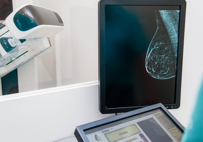 A New Study Challenges the Way We Screen for Breast Cancer